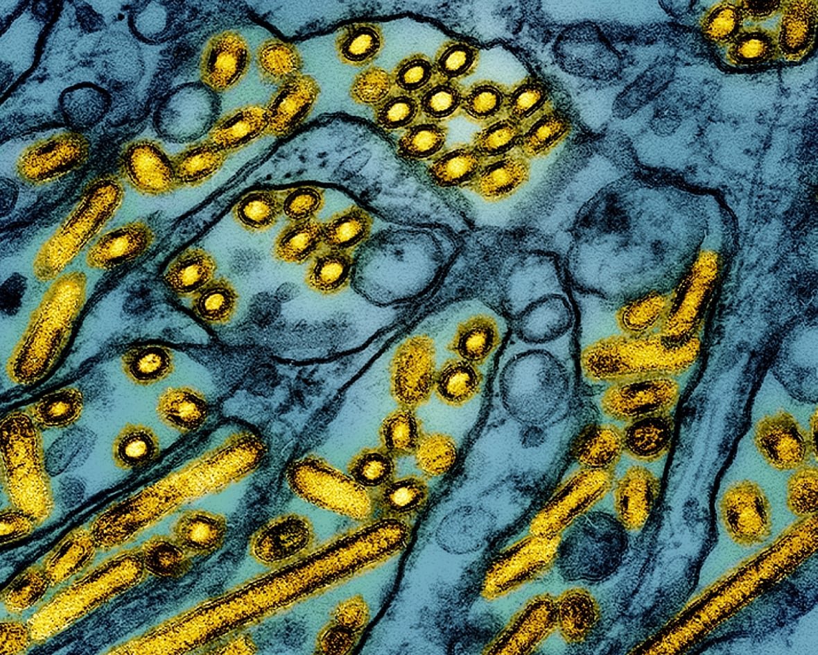 bird-flu A colourized electron microscope image shows avian influenza A H5N1 virus particles (yellow), grown in canine kidney epithelial cell cultures (blue).
