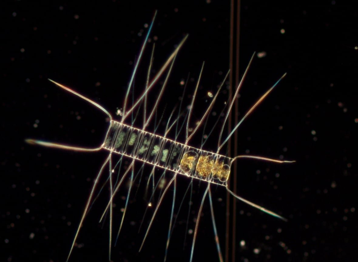 diatom-phytoplankton A diatom phytoplankton, seen under a microscope, looks like a string of attached boxes with long strands coming out from the string.