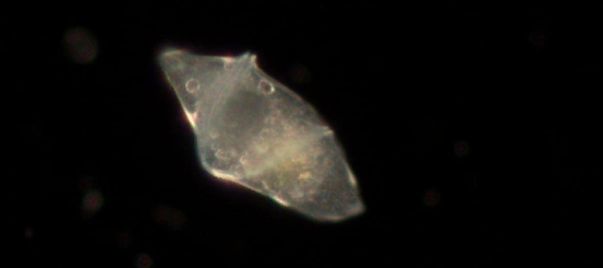 dinoflagellate-phytoplankton A microscope's photo shows a translucent blob pictured against a black background.